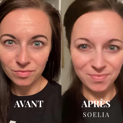 SOELIA™ - Éclat Flash | Le Sérum Coréen Exfoliant au Riz