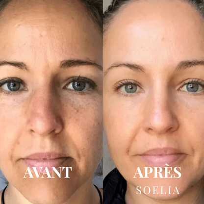 SOELIA™ - Éclat Flash | Le Sérum Coréen Exfoliant au Riz