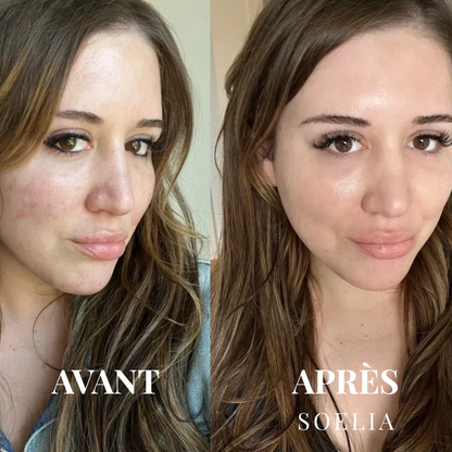 SOELIA™ - Éclat Flash | Le Sérum Coréen Exfoliant au Riz